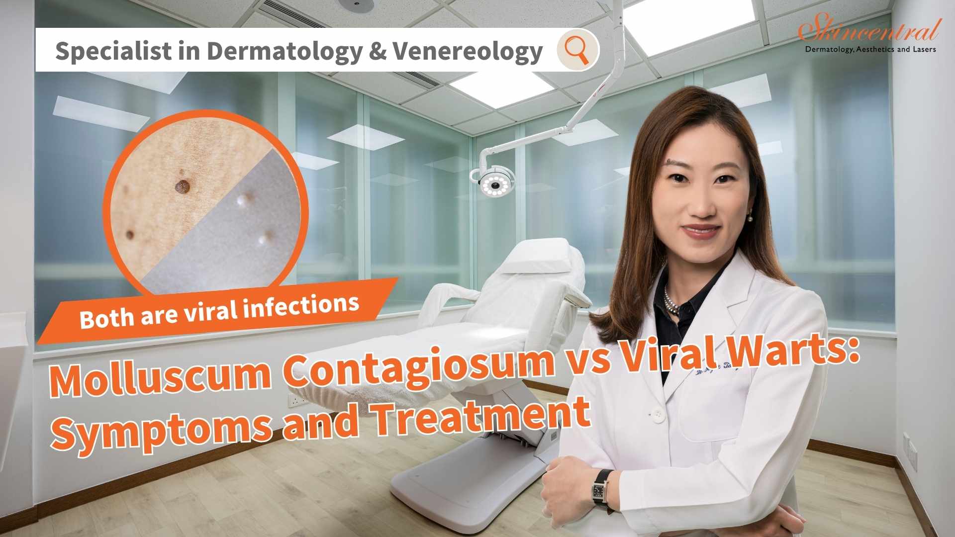 Molluscum Contagiosum vs Warts : What are Symptoms and Treatments by ...